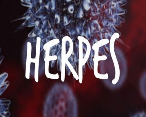 apakah yang dimaksud dengan herpes